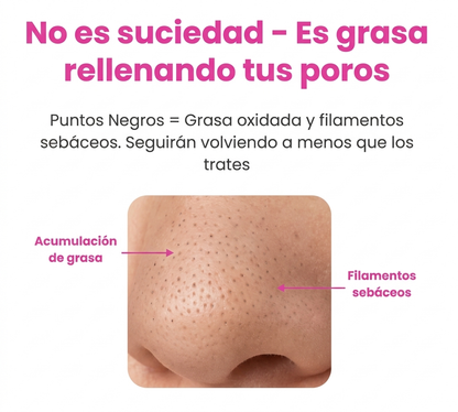 HydraPore™  Quita Puntos Negros con Doble Tanque de Agua